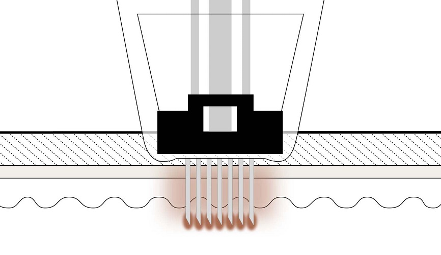 Step 3: Microneedling, how it works