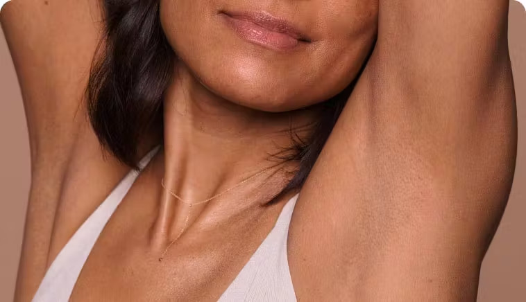 hair removal - results photo of armpits