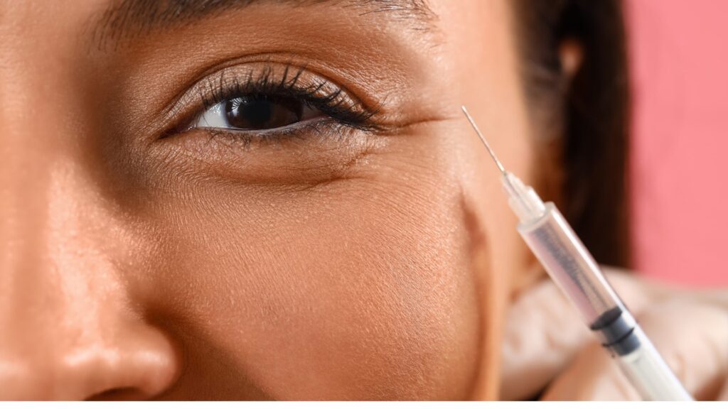 Dermal Fillers Under Eyes