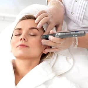 A women under a microneedling procedure