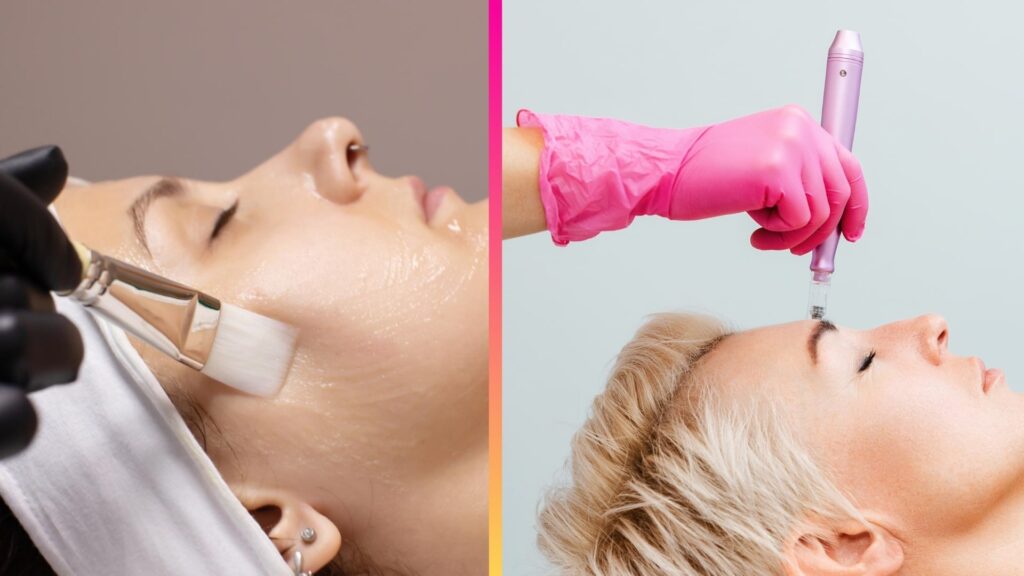 Microneedling vs Chemical Peels