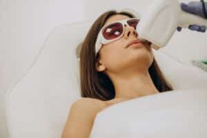 IPL Photofacial Benefits