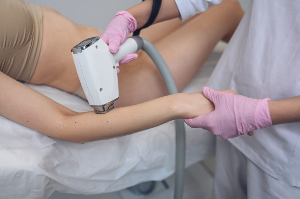 laser hair removal