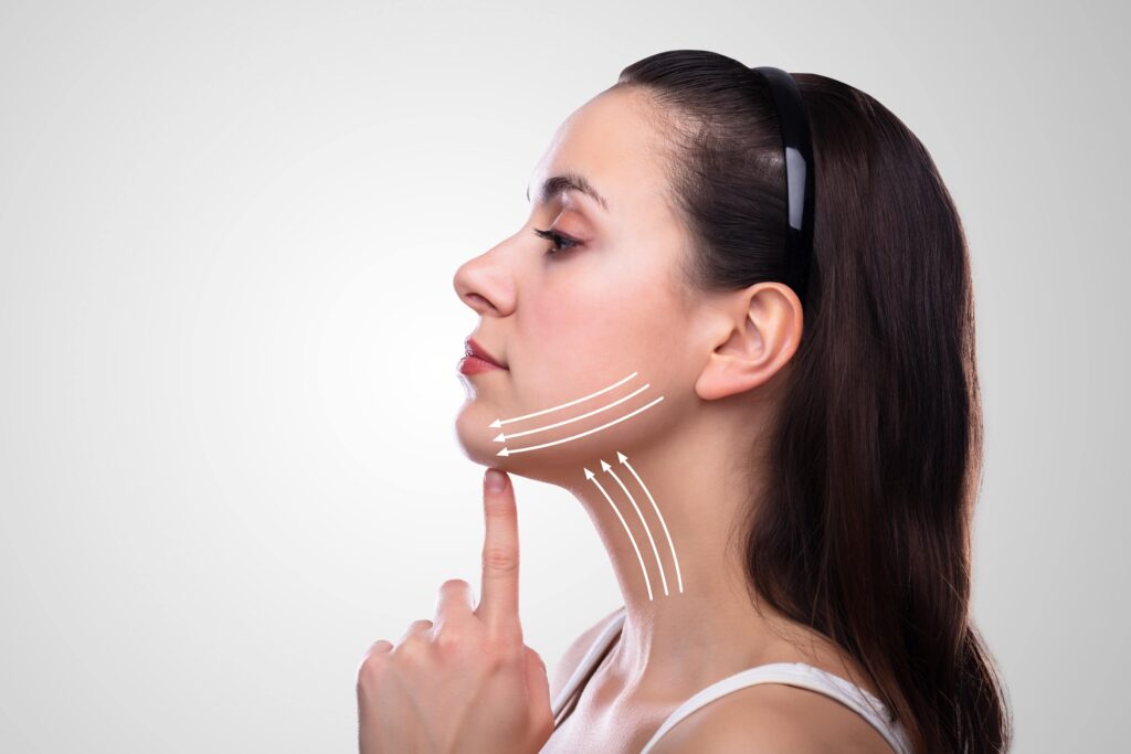 Is Kybella Permanent?