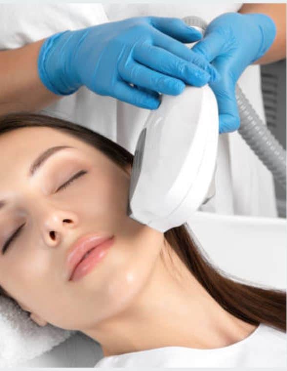 IPL photofacial in Tysons, VA being performed at HS MedSpa